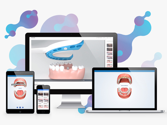 A PlanMaster fogászati szoftver elérhető asztali gépen tableten vagy mobilon